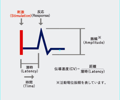 神経伝導検査装置 DPNチェックHDN-1000
