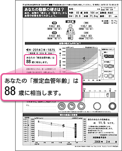 検査結果用紙　No1　推定血管年齢