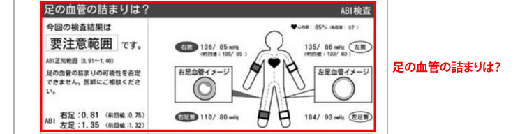 おしゃれ】 【最終値下げ！】血管年齢チェック フォルム 医療機器認定 