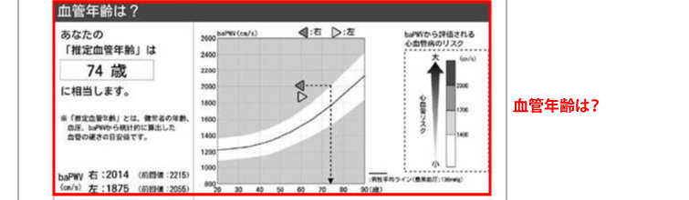 推定血管年齢タイプ｜2の用紙について｜検査結果の見方｜血圧脈波検査 