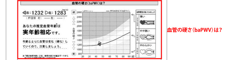 推定血管年齢タイプ｜PT4の用紙について｜検査結果の見方｜血圧脈波 