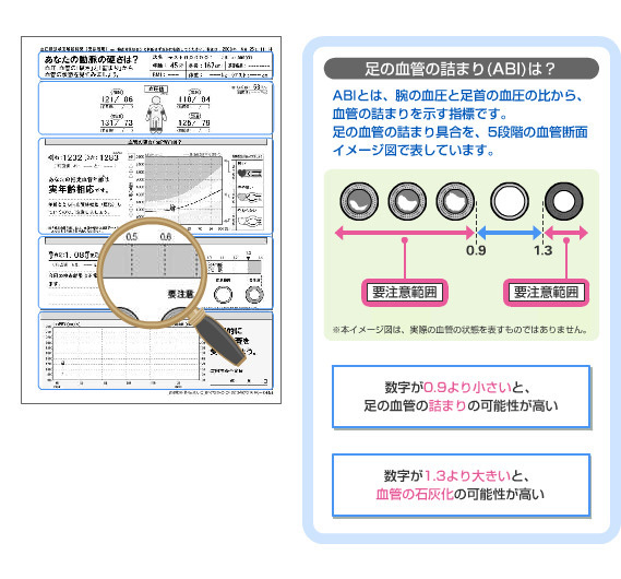 推定血管年齢タイプ｜PT4の用紙について｜検査結果の見方｜血圧脈波 